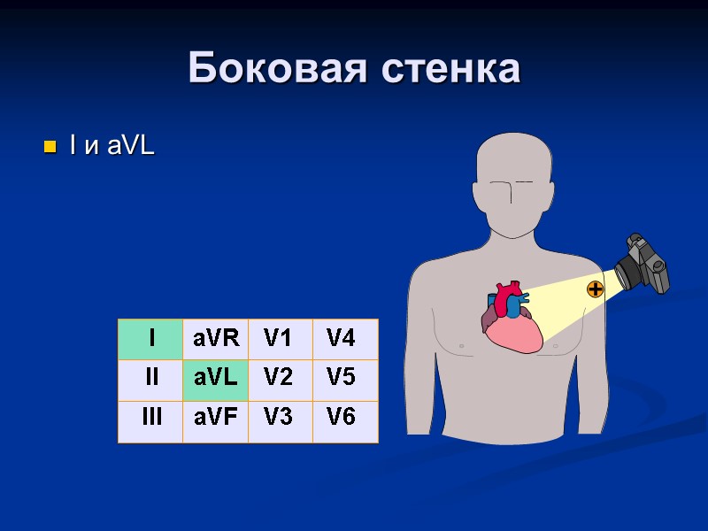 Боковая стенка I и aVL  I II III aVR aVL aVF V1 V2
